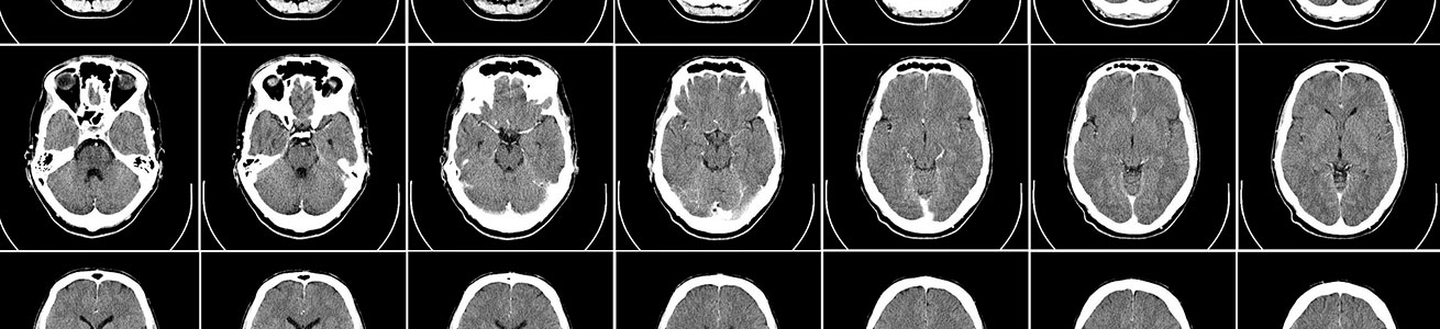 Imagen escaneada del cerebro